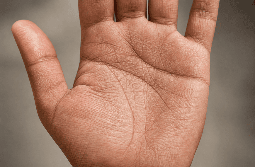 Are Palm Lines Permanent?